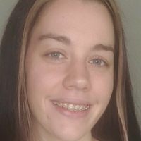 bracefacefree Nackt