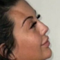 Chlofans Nackt