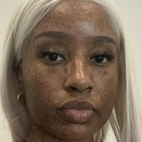 freckledn Nackt