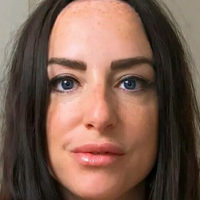 scarred4life3 Nackt